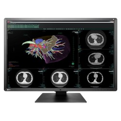 Medical Monitor Eizo