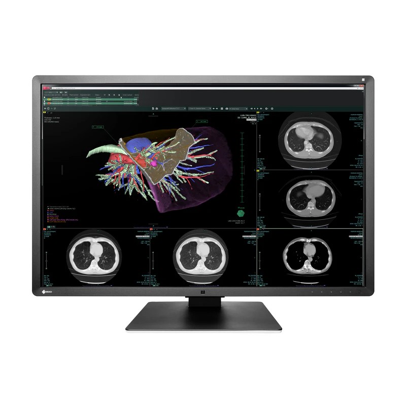 Medical Monitor Eizo
