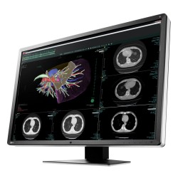 Medical Monitor Eizo