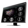 Medical Monitor Eizo